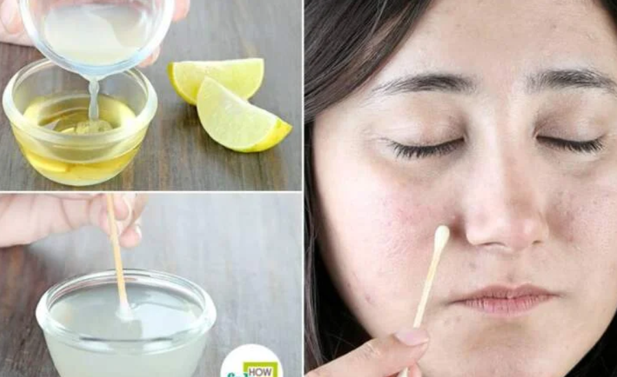 https://wellhealthorganic.com Easily Remove Dark Spots Lemon Juice